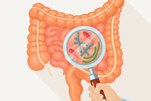 Read more about the article Preventing C. diff in and out of the hospital